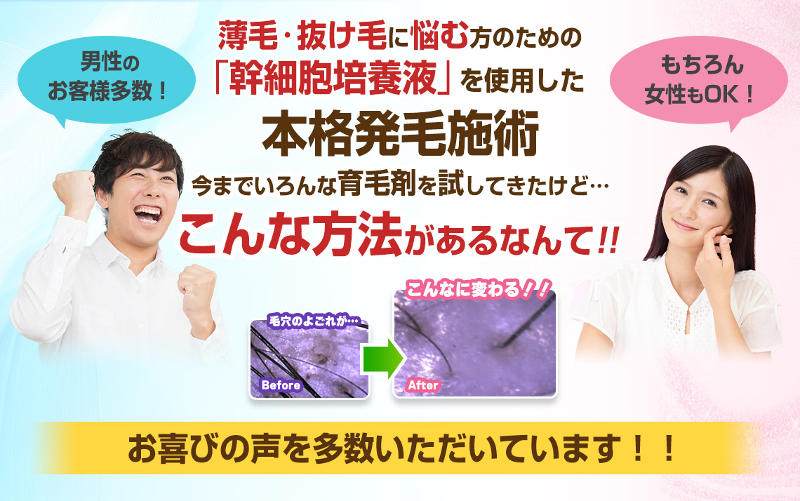 【発毛】本格発毛施術